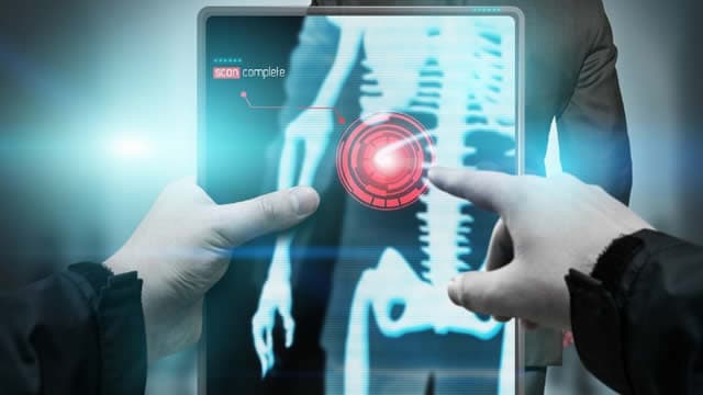 3 Reasons Why Growth Investors Shouldn't Overlook Tactile Systems Technology (TCMD)